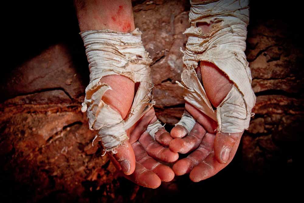 climber with strapped and worn hands